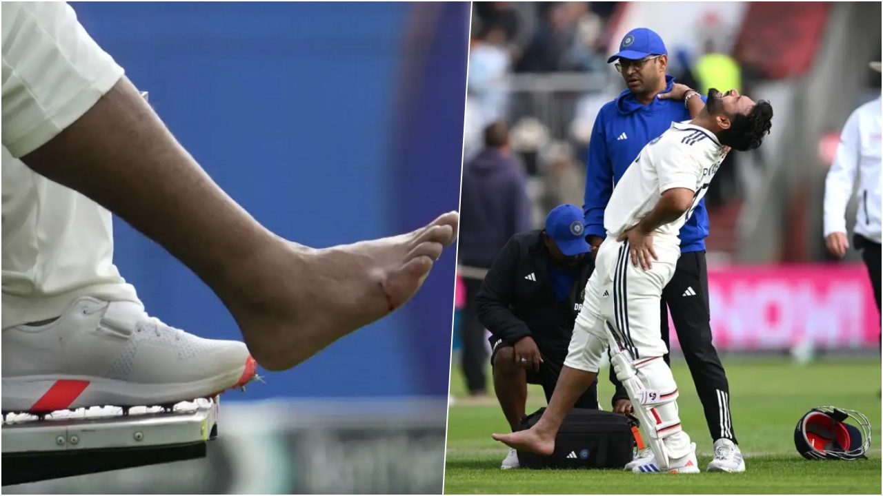 Rishabh Pant Injury