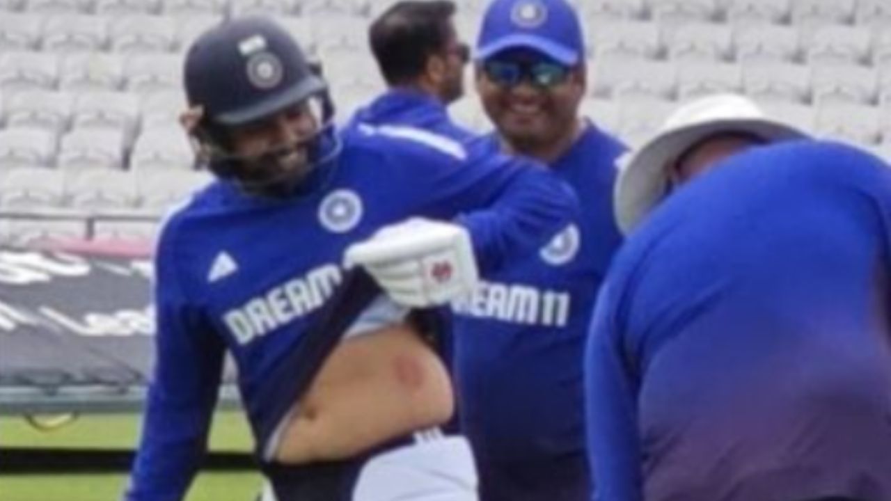 Karun Nair Injury Update before IND vs ENG Headingley Test 2025