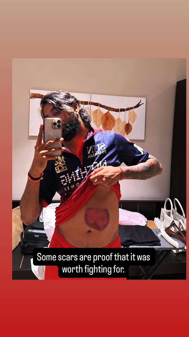 Krunal Pandya Krunal Pandya