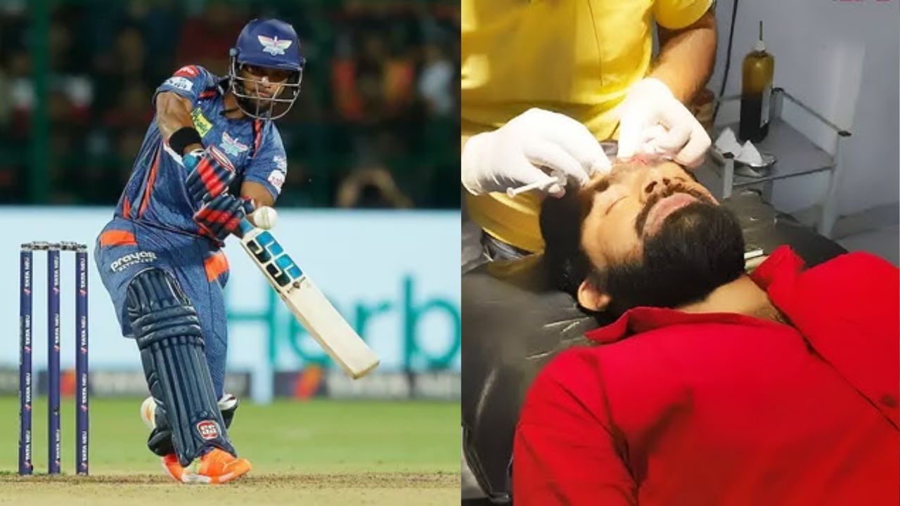 पूरन के गगनचुंबी छक्के ने फोड़ डाला दर्शक का सर! खून से लथपथ व्यक्ति बोला मुझे मैच पूरा मैच देखना है